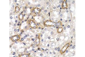 Immunohistochemistry of paraffin-embedded Rat kidney using CD83 Polyclonal Antibody at dilution of 1:200 (40x lens). (CD83 anticorps)