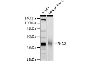 Western blot analysis of extracts of various cell lines, using PHD2 antibody (ABIN7266909) at 1:1000 dilution. (EGLN1 anticorps  (AA 1-426))