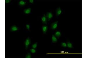 Image no. 2 for anti-AT Rich Interactive Domain 1B (SWI1-Like) (ARID1B) (AA 1364-1461) antibody (ABIN599288) (ARID1B anticorps  (AA 1364-1461))