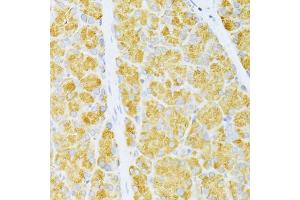 Immunohistochemistry of paraffin-embedded rat pancreas using FLT3 antibody (ABIN6134576, ABIN6140691, ABIN6140694 and ABIN6216061) at dilution of 1:100 (40x lens). (FLT3 anticorps  (AA 650-750))