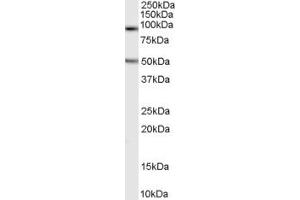 Western Blotting (WB) image for anti-Chromosome 16 Open Reading Frame 90 (C16ORF90) (N-Term) antibody (ABIN2791458) (C16ORF90 anticorps  (N-Term))