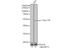 Western blot analysis of extracts of 293T cells, using Phospho-c-Myc-T58 antibody (ABIN3019538, ABIN3019539, ABIN3019540 and ABIN6225454) at 1:500 dilution. (c-MYC anticorps  (pThr58))