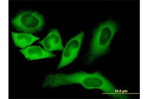Immunofluorescence of monoclonal antibody to FASN on HeLa cell. (Fatty Acid Synthase anticorps  (AA 1-439))
