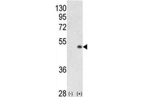 Western blot analysis of PCTAIRE1 antibody and 293 cell lysate (2 ug/lane) either nontransfected (Lane 1) or transiently transfected with the PCTK1 gene (2). (CDK16 anticorps  (AA 357-386))