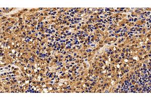 Detection of IL13Ra2 in Human Appendix Tissue using Polyclonal Antibody to Interleukin 13 Receptor Alpha 2 (IL13Ra2)