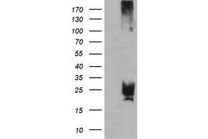 Image no. 4 for anti-Cytidine Monophosphate (UMP-CMP) Kinase 1, Cytosolic (CMPK1) antibody (ABIN1497541)
