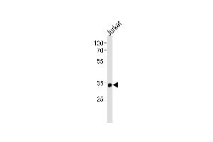 Western blot analysis in Jurkat cell line lysates (35ug/lane).