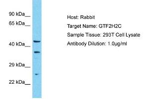 Host: Rabbit Target Name: GTF2H2C Sample Type: 293T Whole Cell lysates Antibody Dilution: 1. (GTF2H2C anticorps  (N-Term))