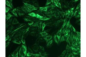 Immunocytochemistry staining of cytokeratin 8 in Hep-2 cells using mouse monoclonal antibody C-51 ((ABIN94298), diluted 1:200), detected with GAM IgG-Alexa Fluor488 (diluted 1:100, green).