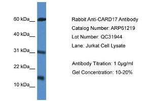 Western Blotting (WB) image for anti-Caspase Recruitment Domain Family, Member 17 (CARD17) (Middle Region) antibody (ABIN2788724) (CARD17 anticorps  (Middle Region))