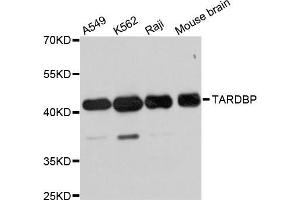Western blot analysis of extracts of various cell lines, using TARDBP antibody (ABIN5999467) at 1/1000 dilution. (TARDBP anticorps)