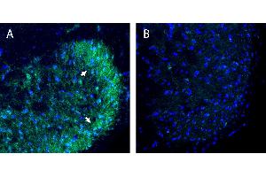 Free-floating frozen spinal cord sections from a paraformaldehyde-perfused rat were incubated with Anti-B1 Bradykinin Receptor (BDKRB1) (extracellular) Antibody (ABIN7581830, 1:300), followed by goat anti-rabbit secondary antibody conjugated to Alexa Fluor® 488 (green).