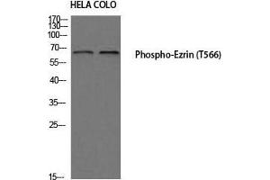 Western Blot (WB) analysis of HeLa COLO205 using Phospho-Ezrin (T566) antibody. (Ezrin anticorps  (pThr566))
