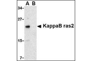 Western blot analysis of KappaB ras2 in RAW264. (NKIRAS2 anticorps  (C-Term))
