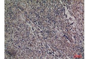 Immunohistochemistry (IHC) analysis of paraffin-embedded Human Brain, antibody was diluted at 1:100.
