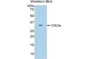 Detection of Recombinant NES, Human using Monoclonal Antibody to Nestin (NES) (Nestin anticorps  (AA 178-399))