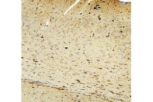 IHC analysis of FACL4/ACSL4 using anti-FACL4/ACSL4 antibody (ABIN7602756). (ACSL4 anticorps  (C-Term))