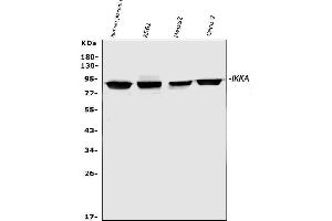 Western blot analysis of IKK alpha using anti-IKK alpha antibody (ABIN3043812). (IKK alpha anticorps  (AA 411-745))