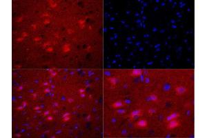 Formalin-fixed and paraffin embedded rat brain labeled with Rabbit Anti-Bax (Ser184) Polyclonal Antibody, Unconjugated used at 1:200 dilution for 40 minutes at 37°C.