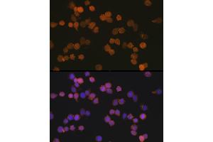 Immunofluorescence analysis of THP-1 cells using //IB Rabbit mAb (9776) at dilution of 1:100 (40x lens). (Iba1 anticorps)