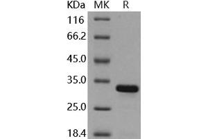 Western Blotting (WB) image for BCL2-Like 1 (BCL2L1) (AA 1-212) (Active) protein (His tag) (ABIN7320439) (BCL2L1 Protein (AA 1-212) (His tag))