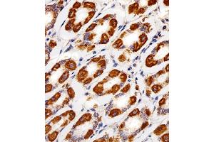 Immunohistochemical analysis of paraffin-embedded H.