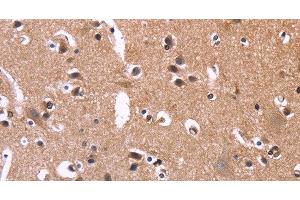 Immunohistochemistry of paraffin-embedded Human brain tissue using SELPLG Polyclonal Antibody at dilution 1:50 (SELPLG anticorps)