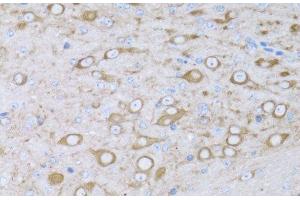 Immunohistochemistry of paraffin-embedded Mouse brain using MYH10 Polyclonal Antibody at dilution of 1:100 (40x lens). (MYH10 anticorps)