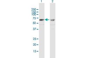 Western Blot analysis of ZNF284 expression in transfected 293T cell line by ZNF284 MaxPab polyclonal antibody. (ZNF284 anticorps  (AA 1-593))