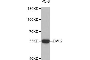 Western blot analysis of extracts of PC-3 cells, using EML2 antibody (ABIN5972622). (EML2 anticorps)
