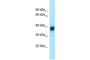 WB Suggested Anti-Olfr329-ps Antibody Titration: 1. (OLFR329-PS anticorps  (Middle Region))