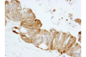 Immunohistochemistry (IHC) image for anti-Stratifin (SFN) (AA 198-248) antibody (ABIN7448925)