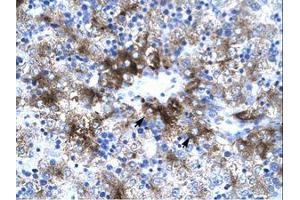 Image no. 1 for anti-Protein Inhibitor of Activated STAT, 3 (PIAS3) (AA 548-597) antibody (ABIN202823)