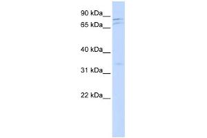 WB Suggested Anti-NEK11 Antibody Titration:  0. (NEK11 anticorps  (Middle Region))