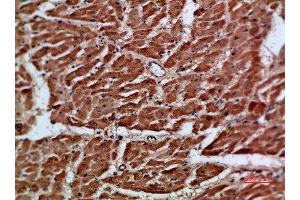 Immunohistochemical analysis of paraffin-embedded human-heart, antibody was diluted at 1:200 (ARTN anticorps  (AA 101-150))