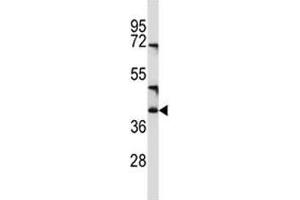 CD1c antibody western blot analysis in NCI-H460 lysate