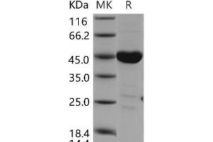 Western Blotting (WB) image for C-Src tyrosine Kinase (CSK) protein (ABIN7320121) (CSK Protéine)
