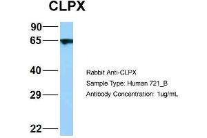 Host: Rabbit Target Name: WT1 Sample Type: 721_B Antibody Dilution: 1. (CLPX anticorps  (C-Term))