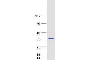 Validation with Western Blot