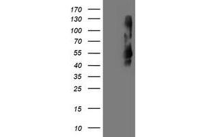 Western Blotting (WB) image for anti-Transmembrane Protein with EGF-Like and Two Follistatin-Like Domains 2 (TMEFF2) antibody (ABIN1501419) (TMEFF2 anticorps)