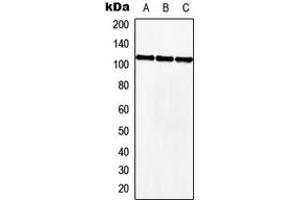 Western blot analysis of MKL2 expression in HEK293T (A), NIH3T3 (B), H9C2 (C) whole cell lysates. (MKL2 anticorps  (Center))