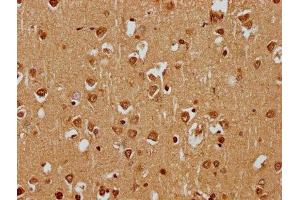 IHC image of ABIN7169769 diluted at 1:400 and staining in paraffin-embedded human brain tissue performed on a Leica BondTM system. (SKOR1 anticorps  (AA 744-965))