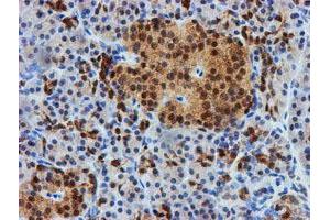 Image no. 7 for anti-F-Box Protein 21 (FBXO21) antibody (ABIN1498235)