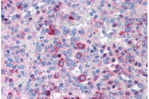 Human Spleen (formalin-fixed, paraffin-embedded) stained with GATA3 antibody ABIN214763 at 5 ug/ml followed by biotinylated goat anti-rabbit IgG secondary antibody ABIN481713, alkaline phosphatase-streptavidin and chromogen. (GATA3 anticorps  (AA 364-413))