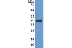 WB of Protein Standard: different control antibodies against Highly purified E.