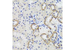 Immunohistochemistry of paraffin-embedded mouse kidney using MTERFD3 antibody. (MTERFD3 anticorps)