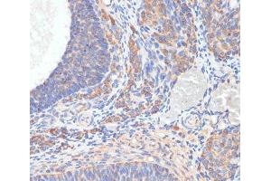 Immunohistochemistry of paraffin-embedded Rat ovary using TES Polyclonal Antibody at dilution of 1:100 (40x lens). (TES anticorps)