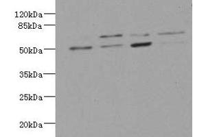 Western blot All lanes: LDB3 antibody at 3. (LIM Domain Binding 3 Protein anticorps  (AA 1-283))