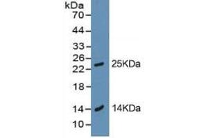 Rabbit Capture antibody from the kit in WB with Positive Control: BXPC-3 cell lysate. (Trypsin Kit ELISA)