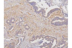 IHC analysis of RAB3GAP2 using anti-RAB3GAP2 antibody (ABIN6719633). (RAB3GAP2 anticorps  (AA 1-115))